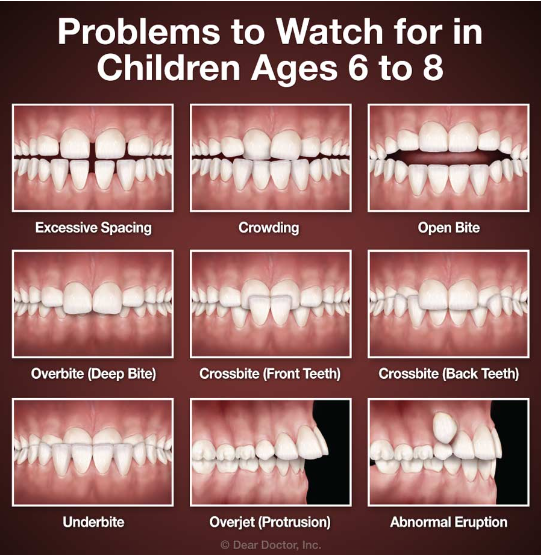 Orthodontic Treatment