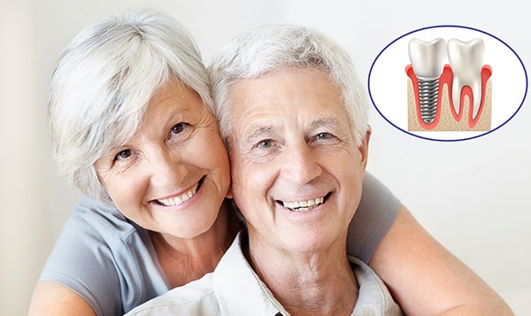 The appropriate age for Dental Implants