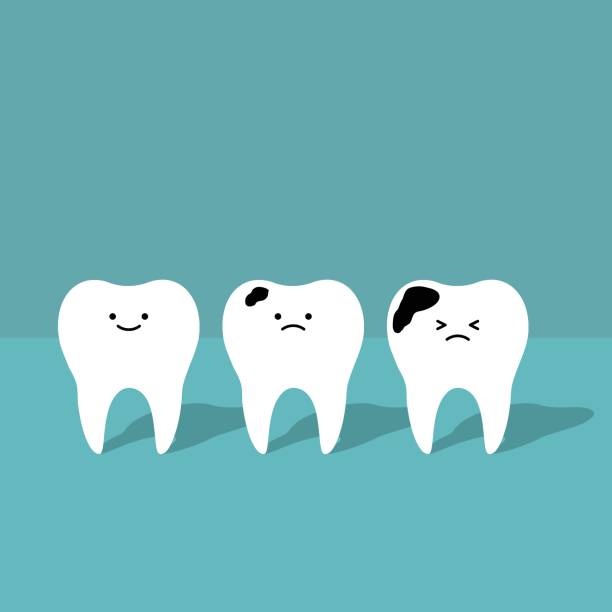 Tooth decay: Symptoms, causes, treatment, and prevention